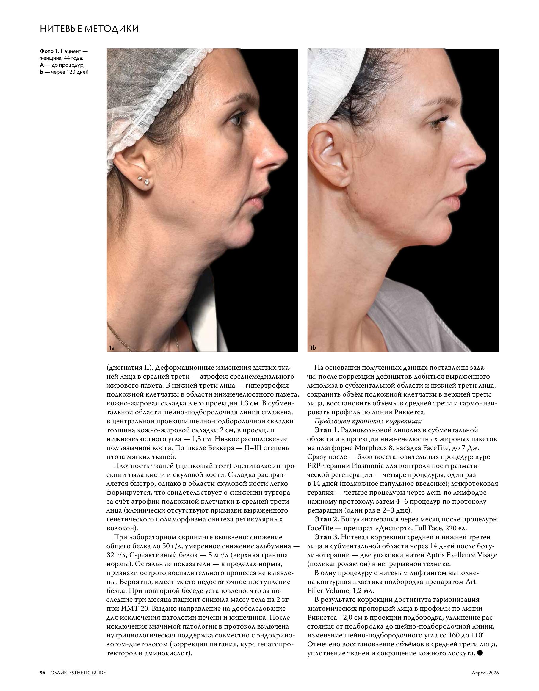 file-3.jpg