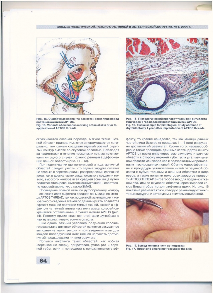 Анналы пластической реконструктивной и эстетической хирургии 1-2007