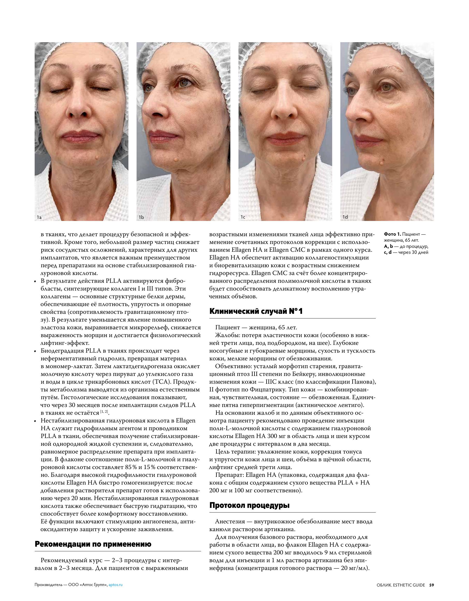 Облик Аптос_ffile-3.jpg