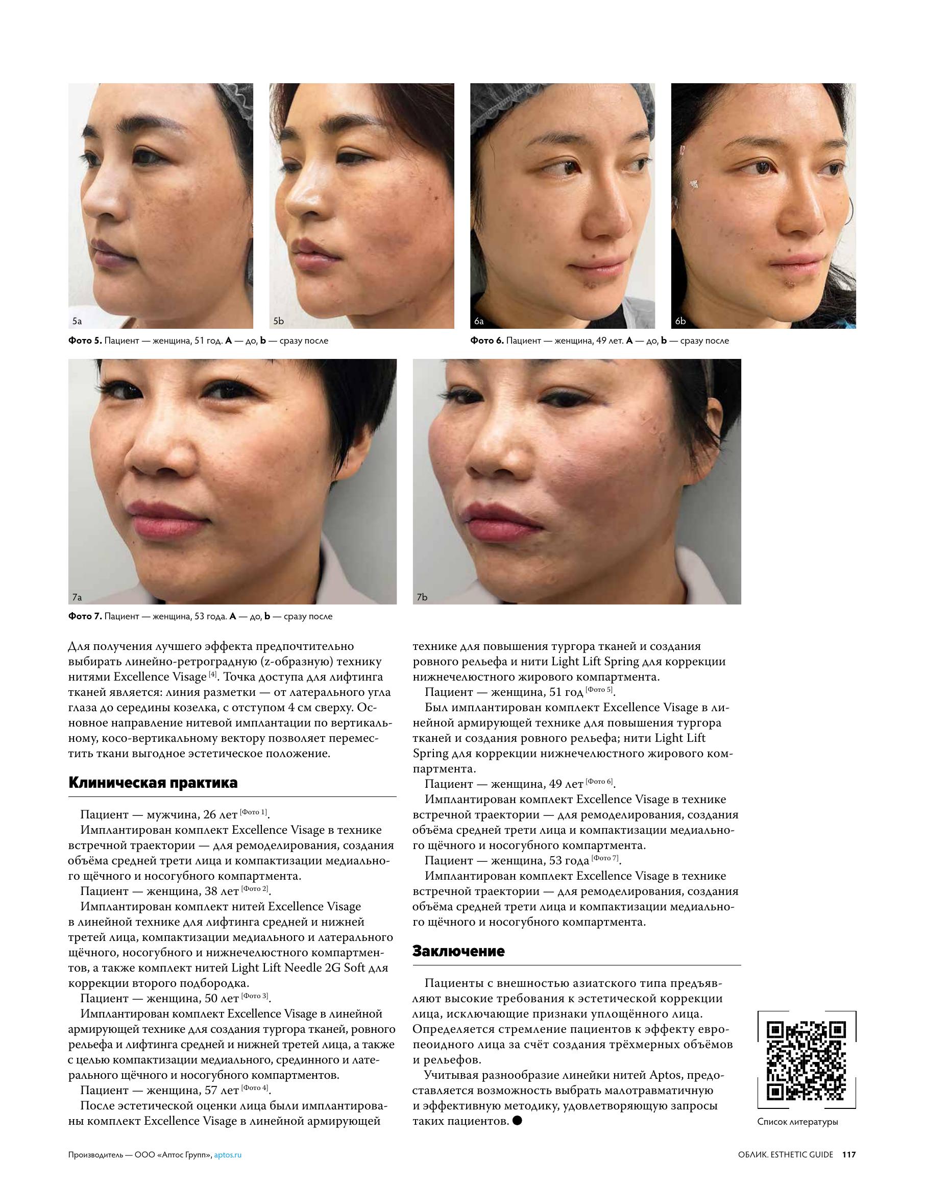 Облик (Aptos)_file-4.jpg