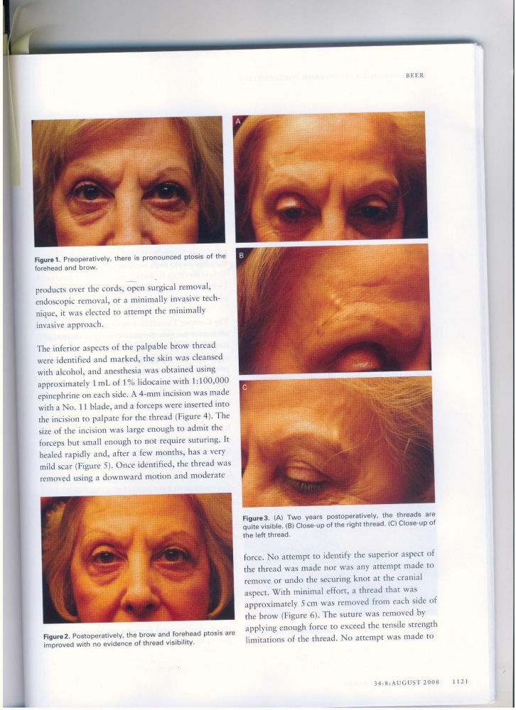 Dermatologic Surgery Volume 34 number 8 August 2008