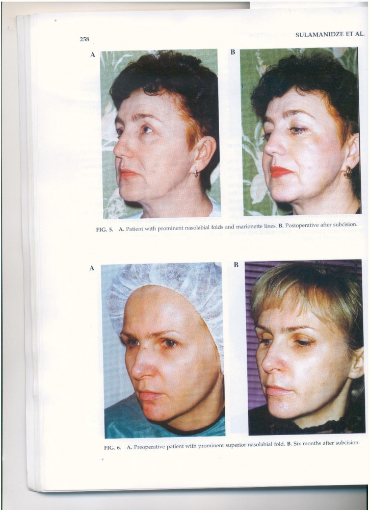 International Journal of Cosmetic Surgery and Aesthetic Dermatology v2, #4, 2000