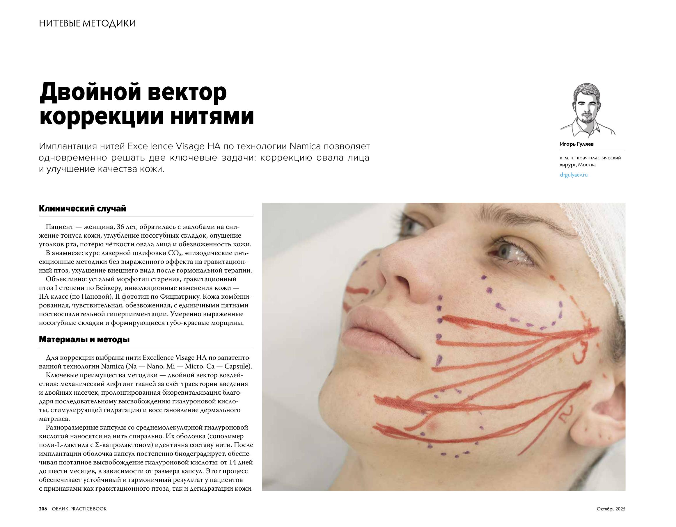 Облик_Aptos file-2.jpg