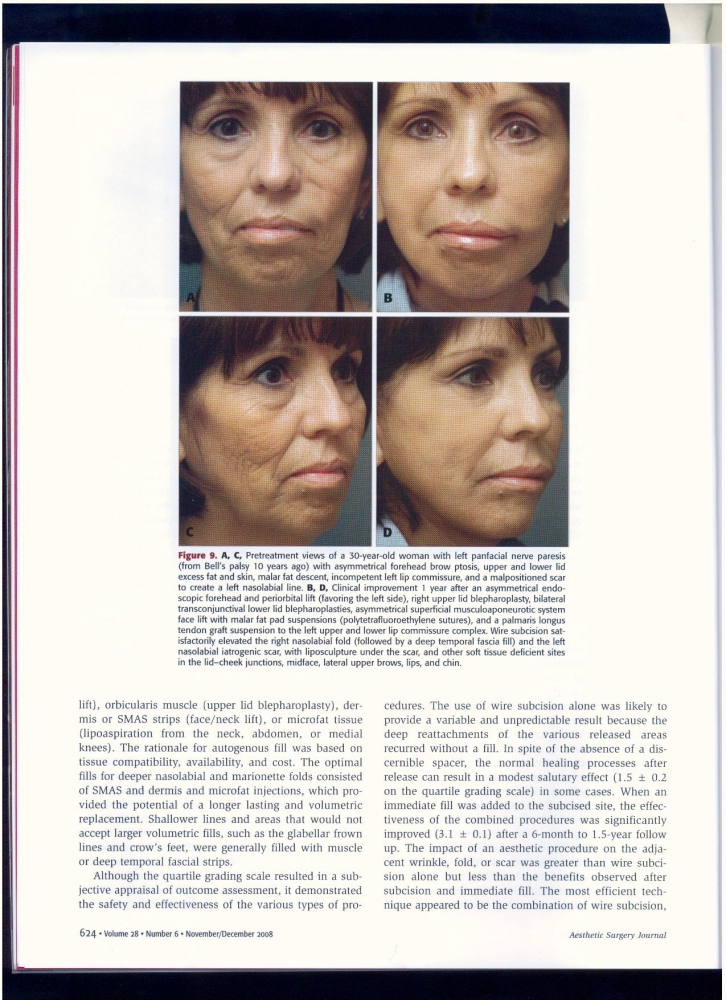 Aesthetic Surgery Journal Volume 28, Issue 6, Nov 2008