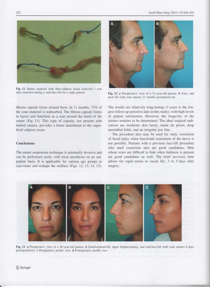 Aesthetic Plastic Surgery Volume 35 Issue 2 Apr 2011