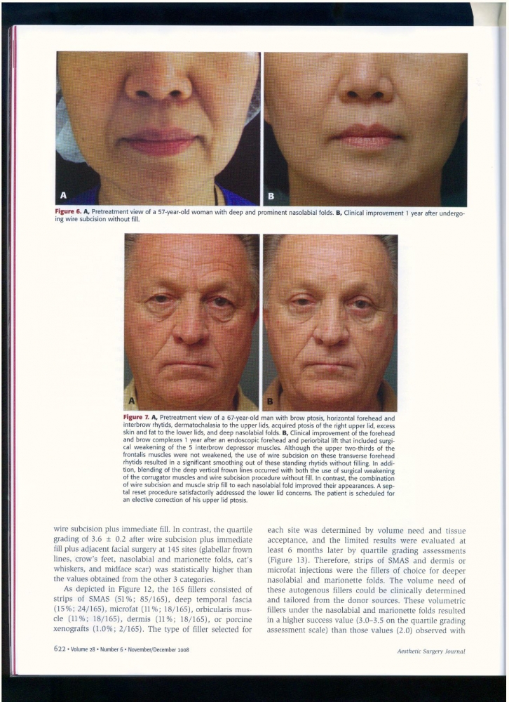 Aesthetic Surgery Journal Volume 28, Issue 6, Nov 2008