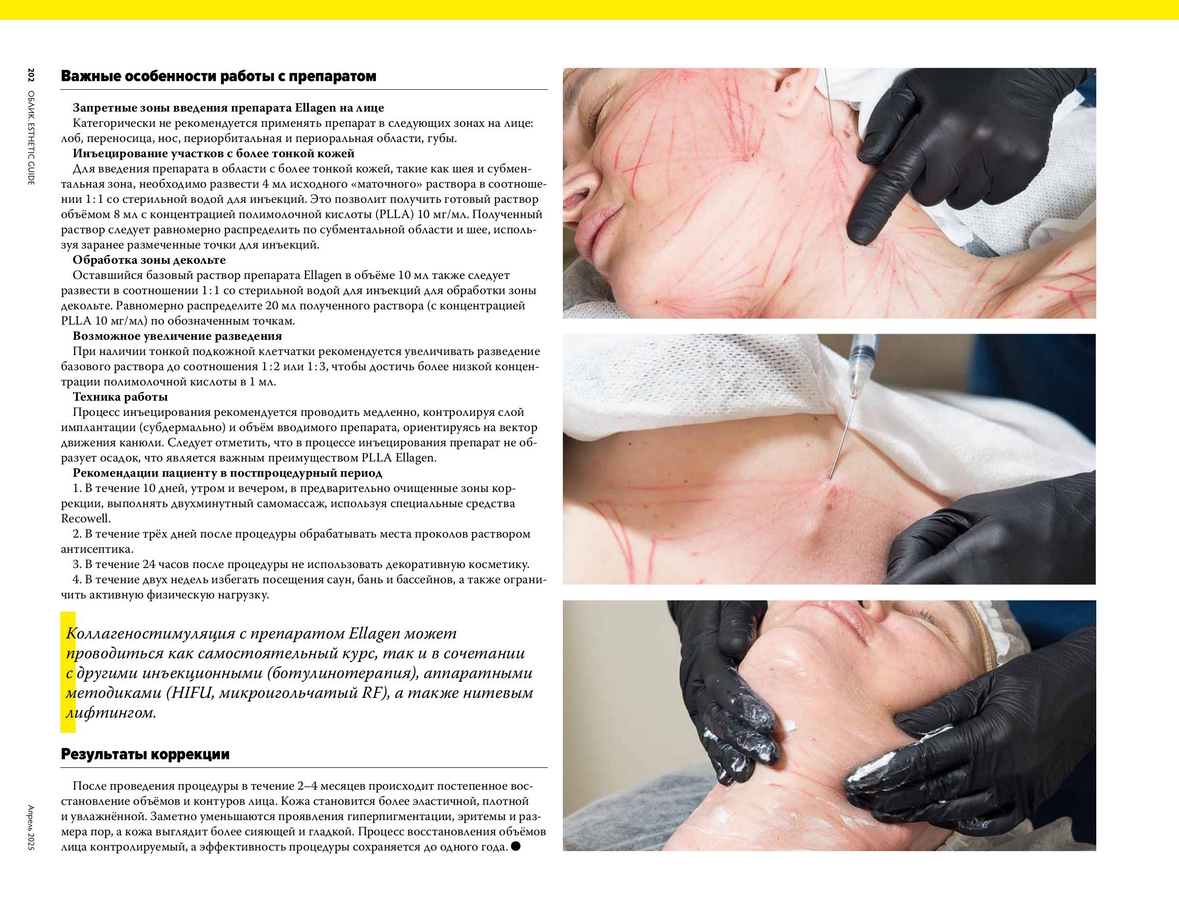 Облик Аптос_ffile-4.jpg