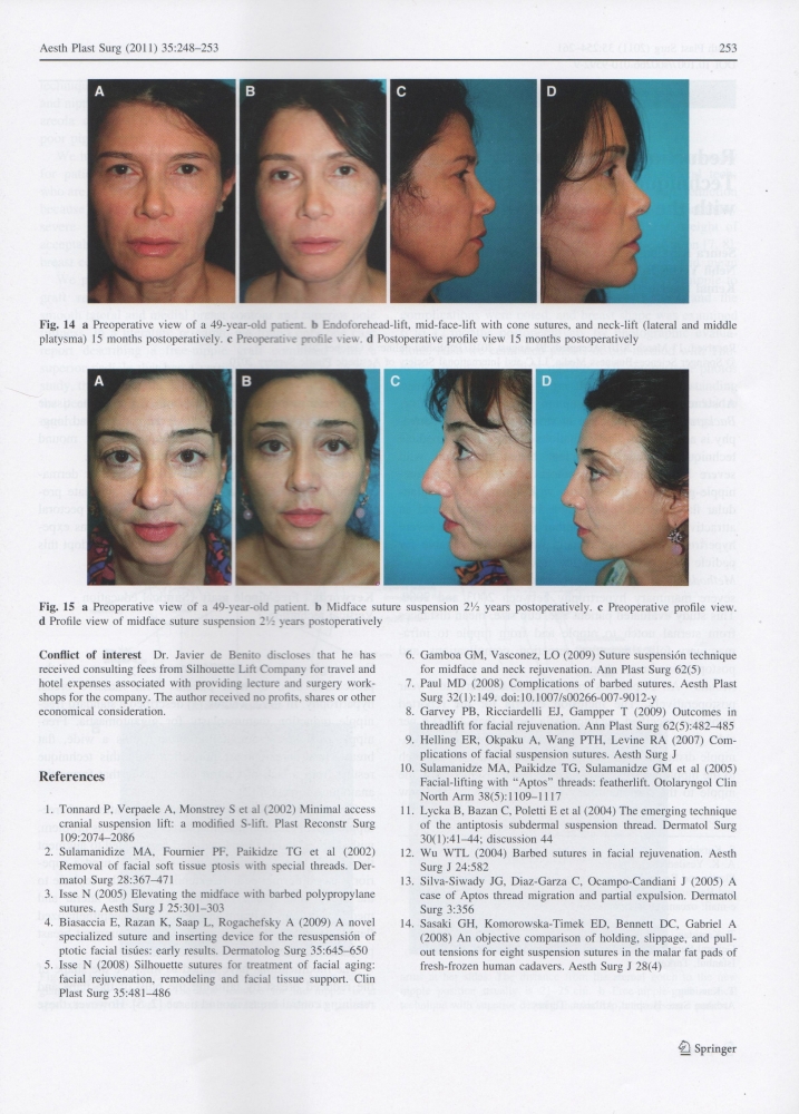Aesthetic Plastic Surgery Volume 35 Issue 2 Apr 2011