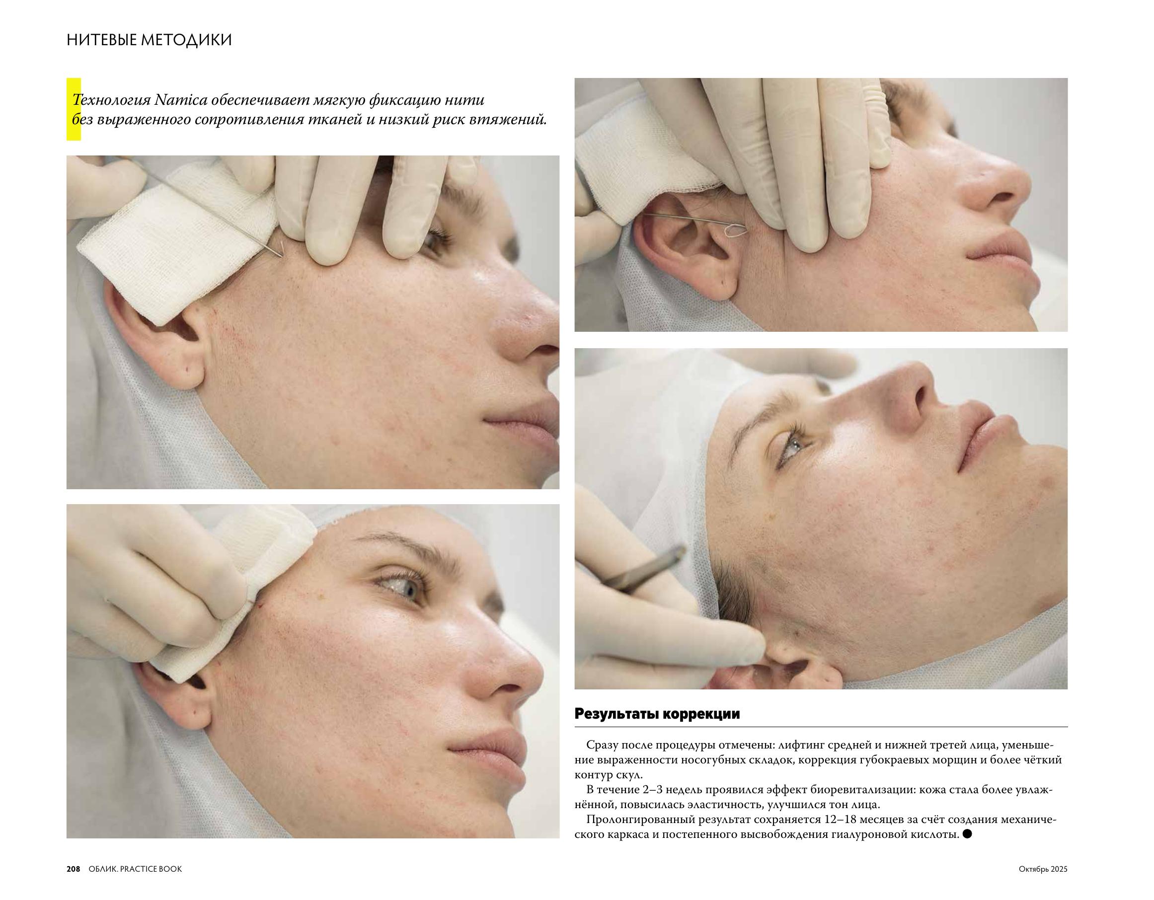 Облик_Aptos file-4.jpg