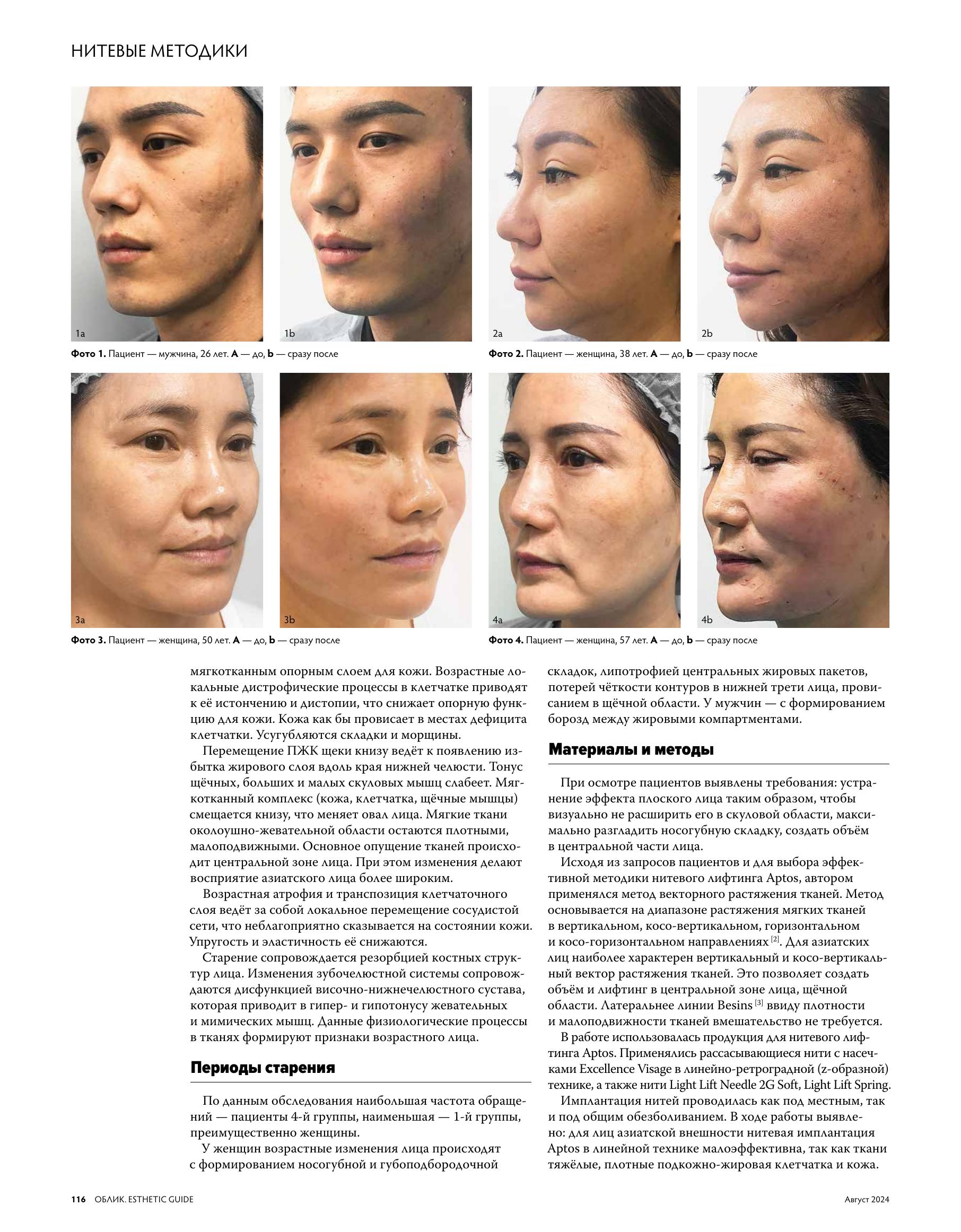 Облик (Aptos)_file-3.jpg