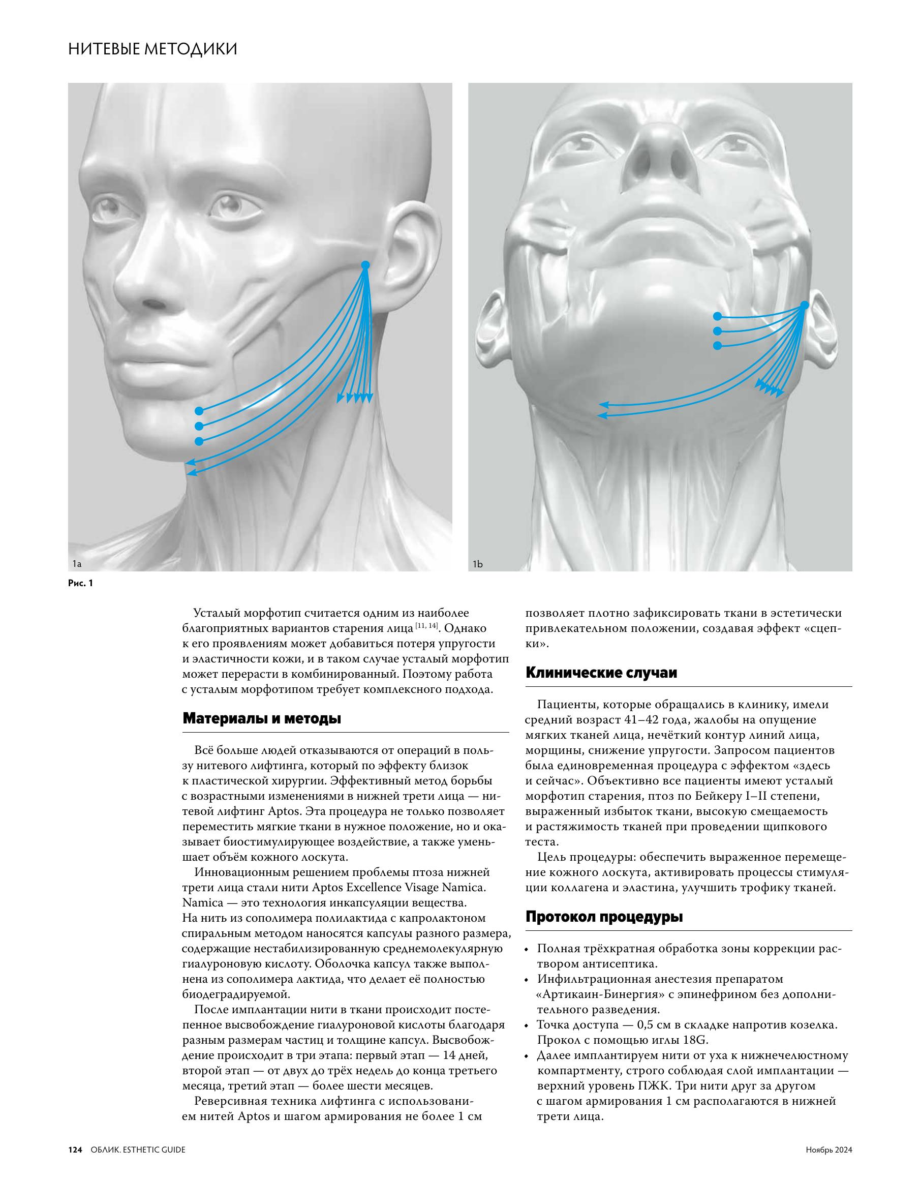 Облик Аптос_file-3.jpg