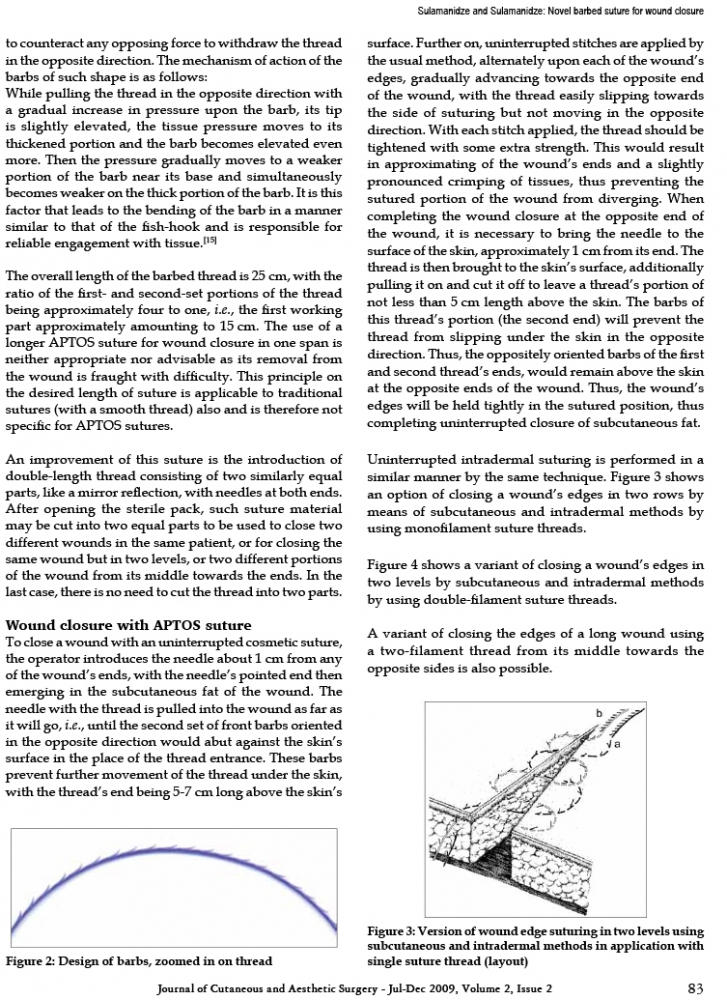 Journal of Cutaneous and Aesthetic Surgery - Jul-Dec 2009, Volume 2, Issue 2