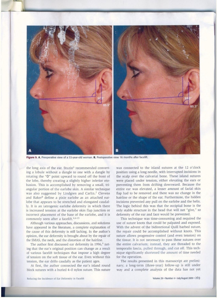 Aesthetic Surgery Journal Volume 29 Issue 4 July -August 2009