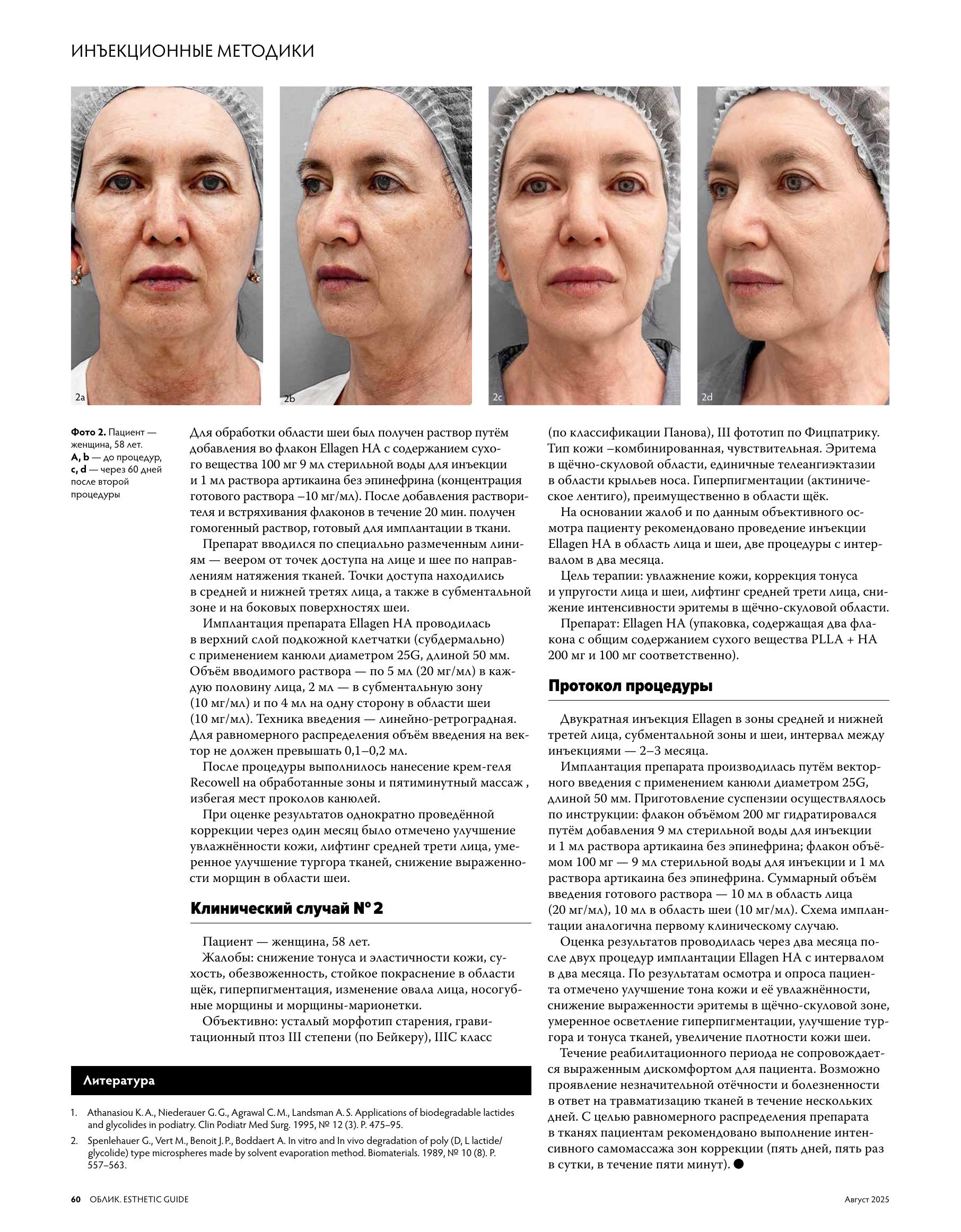 Облик Аптос_ffile-4.jpg