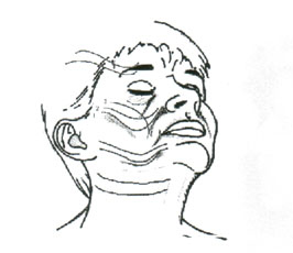 Dermatologic Surgery. May 2002. Number 5. Volume 28