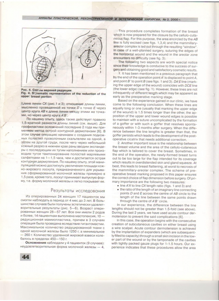Анналы пластической реконструктивной и эстетической хирургии 3-2000