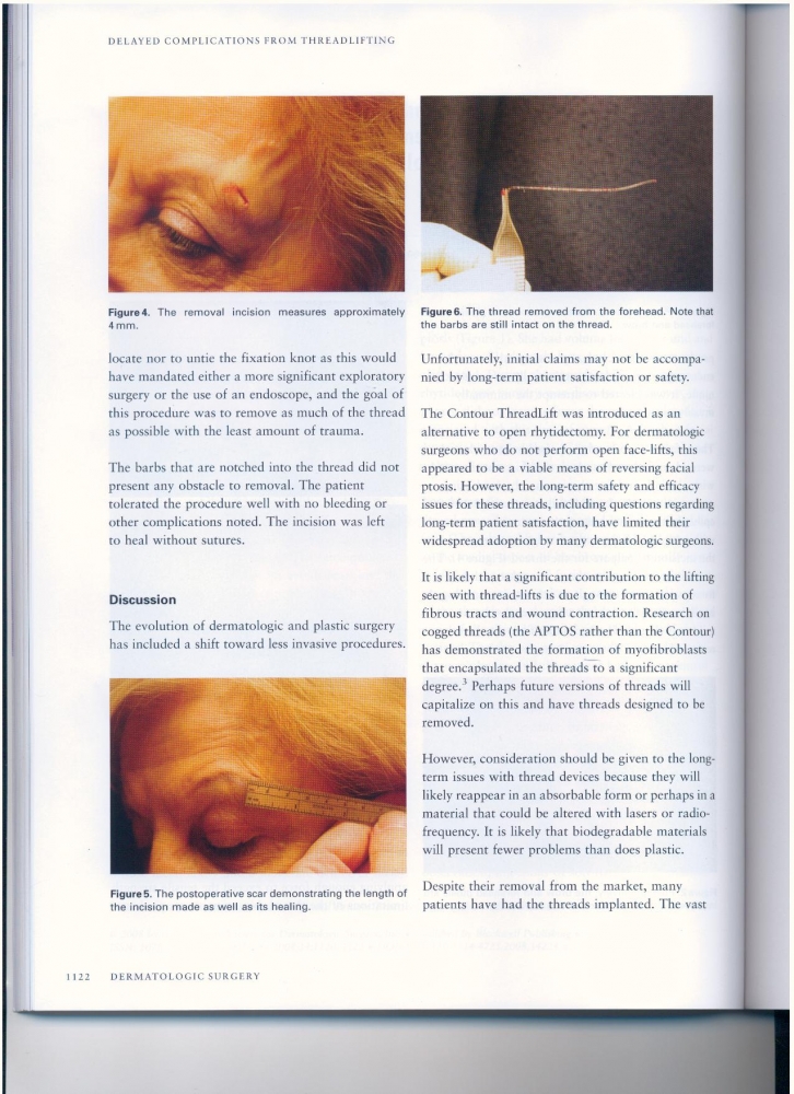 Dermatologic Surgery Volume 34 number 8 August 2008