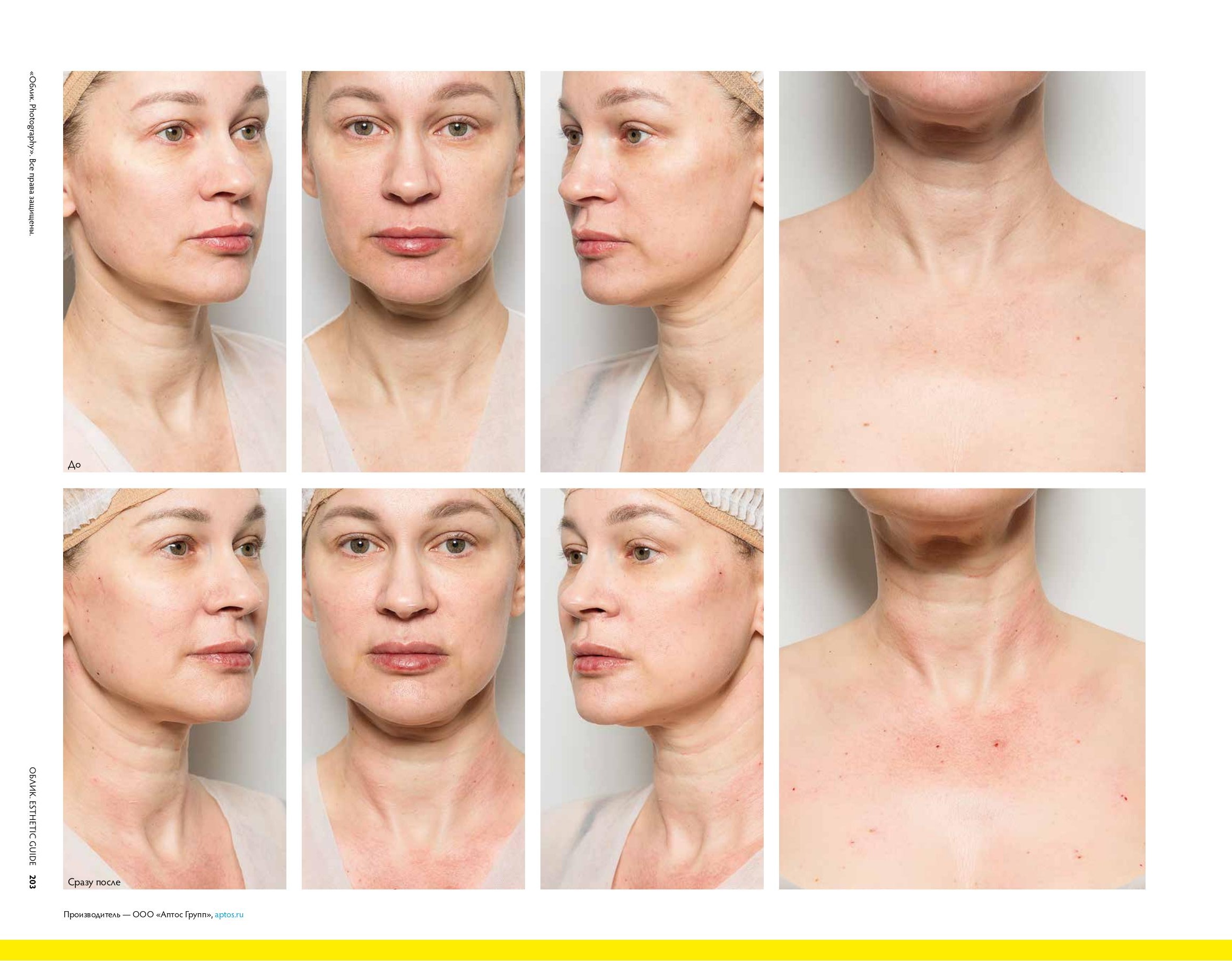 Облик Аптос_ffile-5.jpg