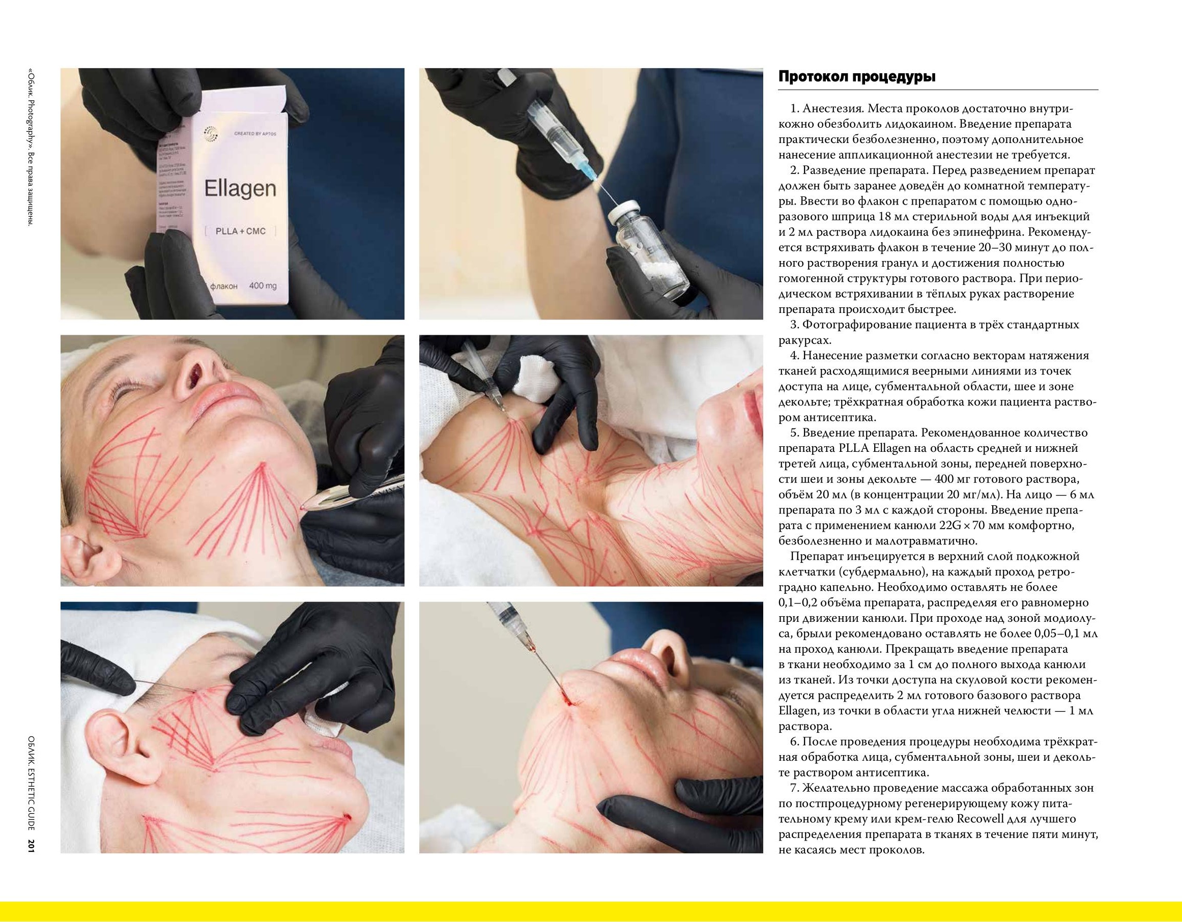 Облик Аптос_file-3.jpg