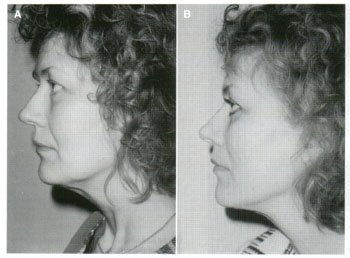 Dermatologic Surgery. May 2002. Number 5. Volume 28
